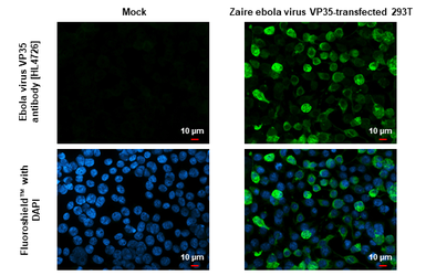 Anti-Ebola virus VP35 antibody [HL4726] used in Immunocytochemistry/ Immunofluorescence (ICC/IF). GTX644730